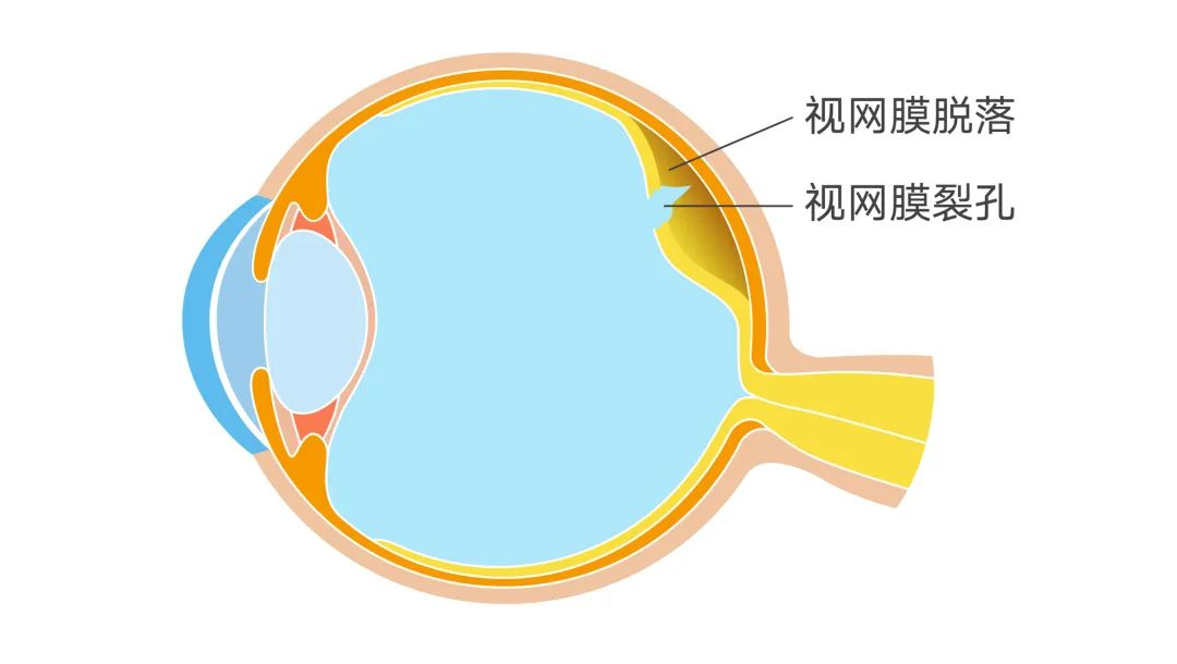 圖片.png